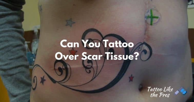 Can You Tattoo Over Scar Tissue