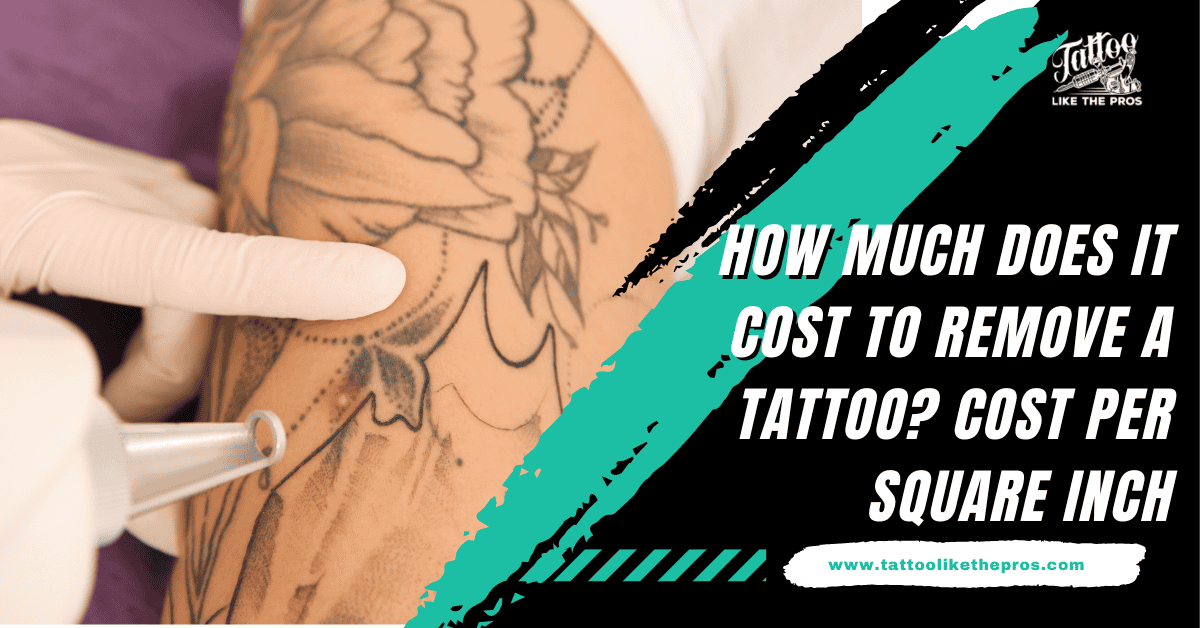 how much does it cost to remove a tattoo